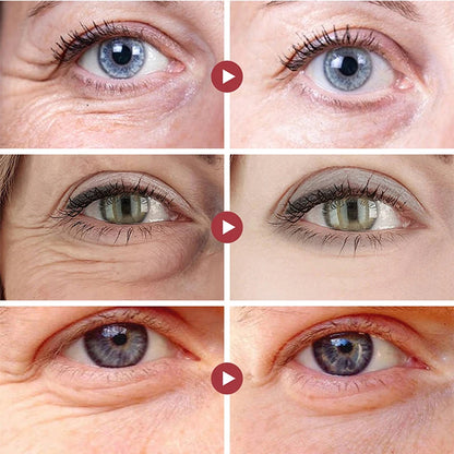Efektyvus paakių kremas (Retinol)