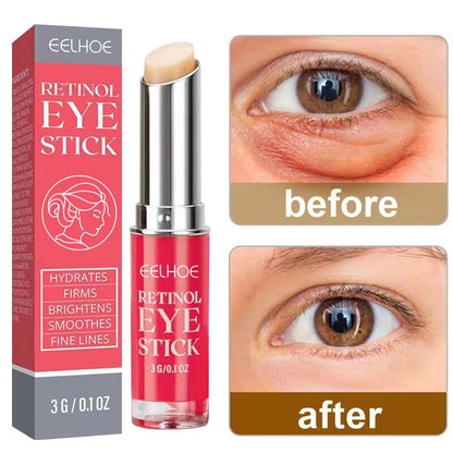 Efektyvus paakių kremas (Retinol)
