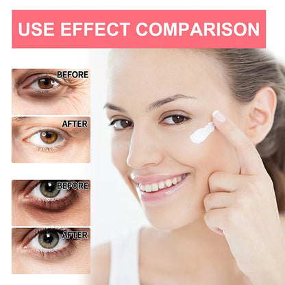 Efektyvus paakių kremas (Retinol)