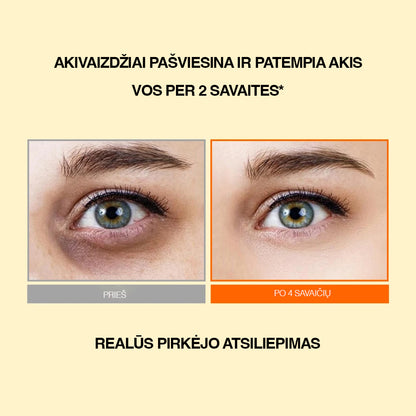 JoyPretty®️ Vitamin C brightening eye serum 