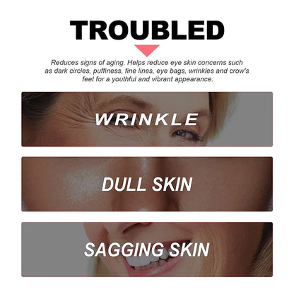 Efektyvus paakių kremas (Retinol)